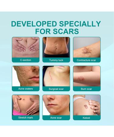 Scar Spray 2pcs Stretch Mark Care 20g - Gentle Skin Care & Scar Removal Spray - Buy Online on GoSupps.com