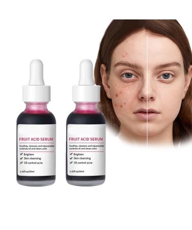 Pemarlis 2PCS Brightening Serum to Remove Dark Spots Oil Corrective Serum for Face and Body for Skin Treatment Against Acne and Pimple Marks