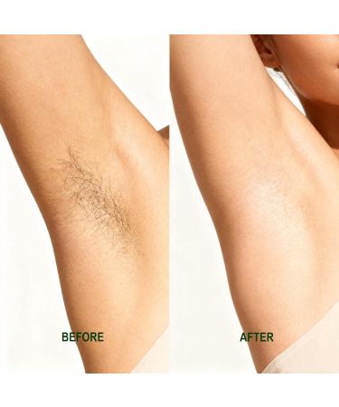 Cyperus Rotundus Oil - Natural Nut Grass Mix Oil for Reducing Body Hair Growth Smooth Skin & Hair Removal Moisturizing & Soothing Ideal for All Skin Types - 4.04fl.oz - Buy Online on GoSupps.com