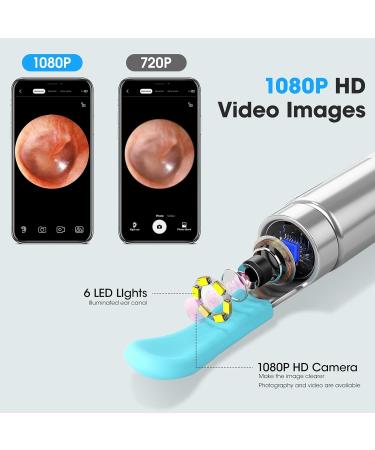 HD 1080P Ear Wax Removal Kit with Camera - 8 Ear Picks for iOS & Android - Improve Hearing & Clean Ears Safely - Buy Online on GoSupps.com