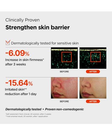 Pixcell Biom 2B/mL Probiotic Essence - Restores Skin Barrier with Bifida Lactobacillus Ferment Lysate Korean Probiotic Drops for acne prone skin and sensitive skin (30ml 1.01 Fl Oz.) 1.01 Fl Oz (Pack of 1) - Buy Online on GoSupps.com