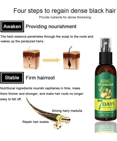 Hair Growth Germinal Oil Anti-Hair Loss Hair Growth Promotes Blood Circulation of the Scalp Prevents Hair Loss - Buy Online on GoSupps.com