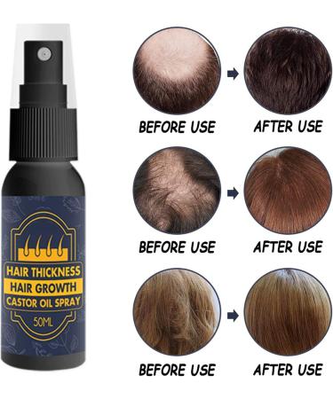 LPDM Castor Oil Spray for Hair Growth & Nourishing - 3 Pack 50ml - For Hair, Eyelashes, and Eyebrows - Buy Online on GoSupps.com