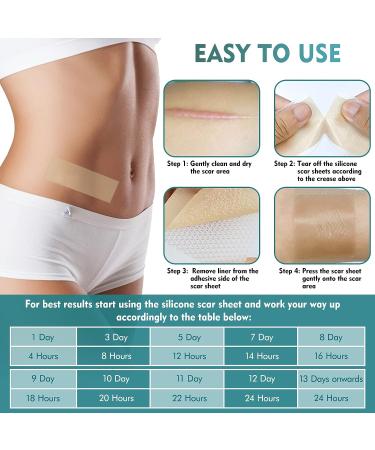 Professional Silicone Scar Sheets Roll 1.6x120 - Effective for C-Section, Surgery, Burns, Keloids - 3M Silicone Tape for Old & New Scars - Buy Online on GoSupps.com