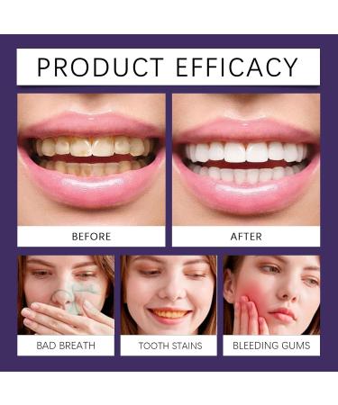 Gentle Care Toothpaste for Optimal Oral Hygiene - Soothes Gums Removes Stains and Keeps Teeth Sparkling White(2PCS) - Buy Online on GoSupps.com