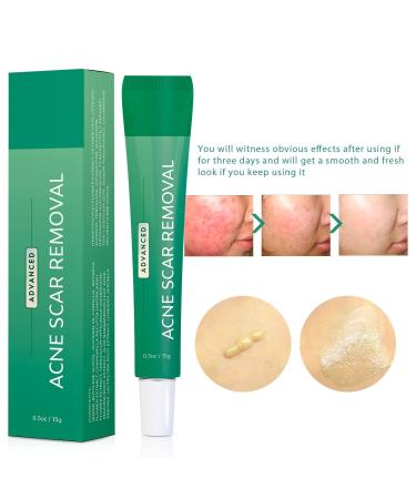 Hello Sunshine Advanced Gel Acne Scar Spot Treatment with Retinol, Allantoin, Vitamin E, Betaine - 0.5 OZ - Buy Online on GoSupps.com