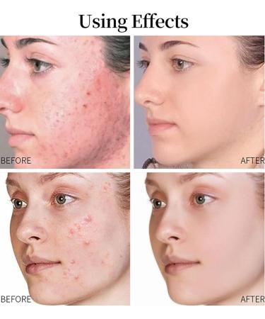 Face Serum Set 3x30ml - Retinol Serum for Face - Hyaluronic Acid Serum - Collagen Serum for Face - Brightening Serum - Hydrating Serum - Dark Spot Remover for Face - Anti-Aging and Wrinkle - Buy Online on GoSupps.com