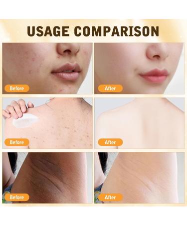 2Pcs Bee Venom Comprehensive Cream Professional Bee Venom Skin Treatment Cream Advanced Firming & Wrinkle-Reducing cream Natural Skin Moisturizer for All Skin Types - Buy Online on GoSupps.com