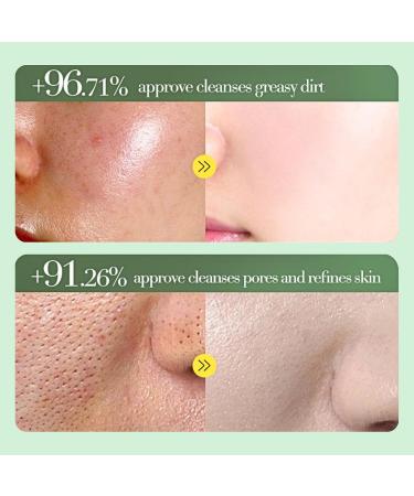 Acne Foaming Wash Acne Face Wash Gentle Face Wash for Acne Prone Skin Anti-Acne Facial Wash for Deep Pore Cleansing Tea Tree Oil Facial Cleanser with Hyaluronic Acid Deep Hydration - Buy Online on GoSupps.com