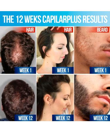 CalviStop Capilar Plus: Hair Growth Supplement & Anti-Androgen Treatment - 60 Count - Buy Online on GoSupps.com