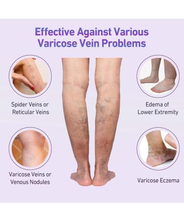 Varicose Vein Cream 3.53 Oz | Soothing Cream for Varicose & Spider Veins | Effective Relief for Legs - Buy Online on GoSupps.com