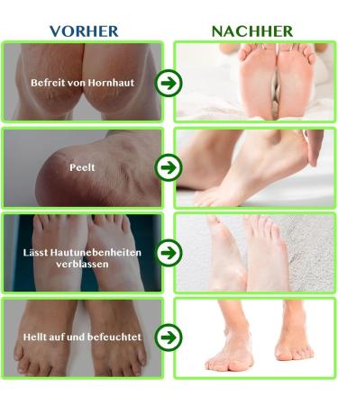P-Beauty Footmaster Aloe - Intensive Foot Care Peeling Socks | Remove Rough Skin Cracks & Calluses | 5 Pairs for Silky Soft Feet - Buy Online on GoSupps.com