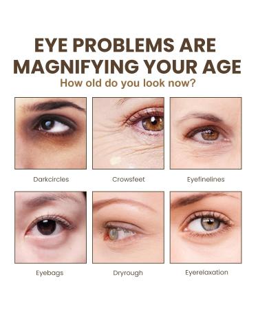 Collagen Retinol Under Eye Cream | Anti-Aging Solution for Dark Circles & Puffiness | Smooth Fine Lines - 0.7 oz - Buy Online on GoSupps.com