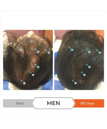 DS LABORATORIES Revita Tablets Hair Growth Supplement - Promotes Thicker, Fuller Hair in Men and Women - Biotin, Vitamin D, Iron - 30 Day Supply, 30 Count - Buy Online on GoSupps.com