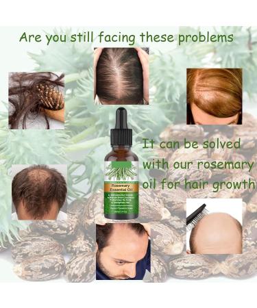 Rosemary Oil for Hair Growth 60ml Hair Oil Diminishes Signs of Aging Nourishes the Scalp Strengthens Hair Stimulates Hair Growth Treat Dry Damaged Hair Rosemary Essential Oil for Hair Growth 2 Brush 30ml - Buy Online on GoSupps.com