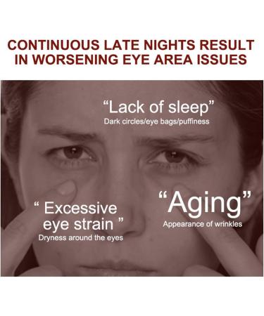 Eye Cream for Dark Circles and Puffy Eyes - Caffeine Eye Cream - Eye Cream Anti Aging for Eye Bags - Improve Eye Area Concerns - Anti Wrinkle Eye Cream Aiming at Lightening Eye Lines - Buy Online on GoSupps.com