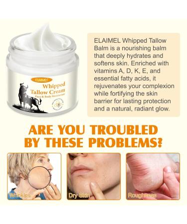Grass-Fed Tallow & Raw Honey Balm | Whipped Skin Cream for Face & Body | Soothes & Repairs Dry Sensitive Skin | Organic All-Natural Deep Hydration (2.1 oz) 2.1 Fl Oz (Pack of 1) - Buy Online on GoSupps.com