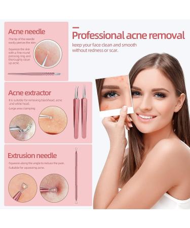 JPNK Blackhead & Acne Removal Kit with Mirror Tweezer - Blemish Extractor Tools Set - Buy Online on GoSupps.com