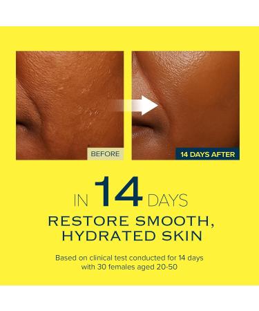 mimmua! Glow Reset Toner | Korean Clinic Skincare - Thioctic Acid & Niacinamide 5% | Gentle Exfoliation w/Pumpkin Extract | Fades Dark Spots & Acne Scars | Deep Hydration | 250ml /8.45 Fl Oz - Buy Online on GoSupps.com