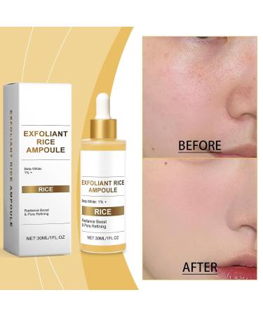 Exfoliating Rice Ampoule Rice Serum for Gentle Face Peel Dead Skin Remover Pore Minimizing & Deep Hydration Exfoliant with Hyaluronic Acid for Glowing Skin All Skin Types (White Rice 30ml) White Rice 1 Fl Oz (Pack of 1) - Buy Online on GoSupps.com