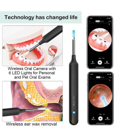Ear Wax Removal Kit with 1296P Camera & WiFi | LED Ear Cleaner for iOS/Android - Soft Silicone Ear Scoop for Effective Ear Cleaning - Buy Online on GoSupps.com