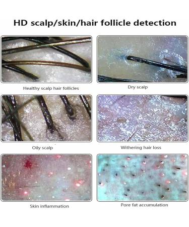 Scalp Hair Follicle Detector Scalp Detector Digital Microscope Skin Analyzer for Hair and Skin Care with Professional Four-in-one Analysis Chart - Buy Online on GoSupps.com
