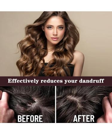 Batana Oil for Hair Growth and Repair 100% Natural Pure Unrefined and Organic Hair Growth Oil Scalp and Hair Care and Enhances Hair Thickness in Men & Women - Buy Online on GoSupps.com