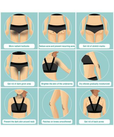 Nakiz Lively Butt Cream for Stretch Marks & Uneven Skin Tone - 100% Authentic (2 Pack) | Award-Winning Formula for Underarm, Inner Thigh, Back, & Knee - Buy Online on GoSupps.com