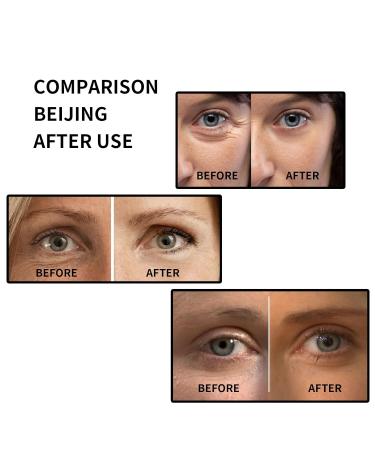 Eye Serum Roller with Grape Seed Oil Glycerin and Castor Oil Anti-Aging Treatment for Fine Lines and Wrinkles Nourishing and Firming Formula 8ml - Buy Online on GoSupps.com