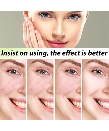 Glycolic Acid 7% Toning Resurfacing Solution Glycolic Sour 7% Toner Glycolic Acid Skin Toner Hydrating Toning Solution for Face Glycolic Acid Toner for Blemishes and Acne and Rejuvenate Your Skin - Buy Online on GoSupps.com