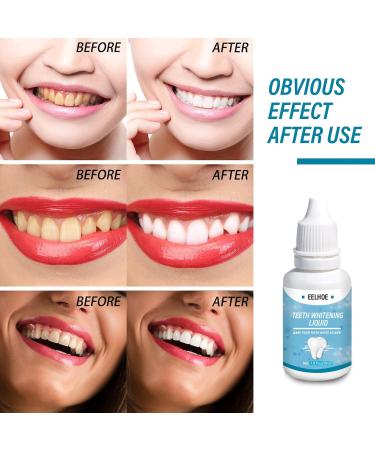 Yueci Teeth Whitening Liquid - Effective Teeth Bleach & Oral Health Care Kit for Whiter Smiles | International Shipping - Buy Online on GoSupps.com