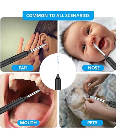 Wireless Ear Wax Removal Tool Camera | 1296P FHD | LED Light | 13 PCS WiFi Earwax Removal Kit | Ear Cleaner for iPhone iPad Android - Black - Buy Online on GoSupps.com