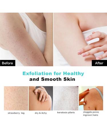 Deep Exfoliating Glove for Shower - Double-Sided Body Scrub Mitt Eco-Friendly Loofah Sponge & Dead Skin Remover - Perfect for Home Spa (Yellow - Buy Online on GoSupps.com