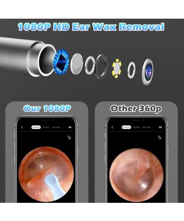Jaydear Wireless Otoscope Ear Cleaner & Camera Kit | 1920P FHD | USB Charging | LED Lights | Ear Wax Removal for iPhone & Android | Black - Buy Online on GoSupps.com