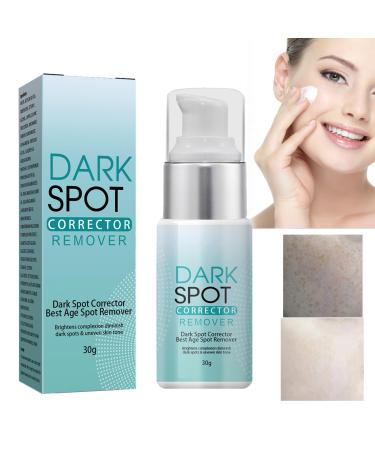 KOAHDE Black Spot Removing Cream Whitening and Freckle Removing Face Cream Spot Lightening Face Cream Dark Spot Corrector Creams Dark Spot Removing Moisture Cream Spot Skin Repairing Face Cream