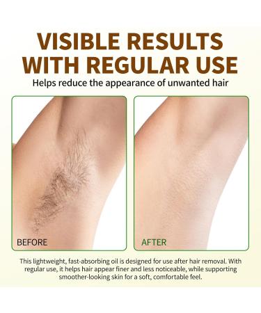 ECHTEYUN Pure Cyperus Rotundus Oil for Hair Removal - Natural & Soothing Formula to Reduce Unwanted Hair Growth Moisturizes Skin (2.02 Fl.Oz) - Buy Online on GoSupps.com