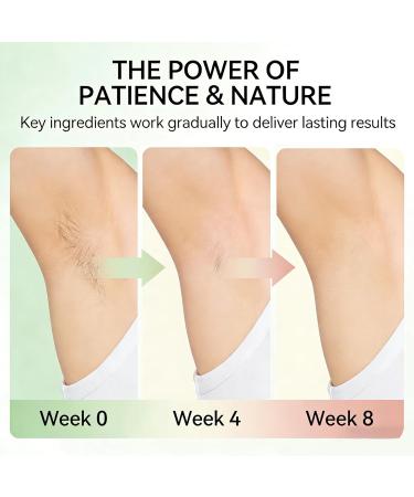Cyperus Rotundus Oil Natural Cyperus Rotundus Oil for Hair Removal Reduces Body Hair Growth Moisturizes & Soothes The Skin Shrinkes Pores Suitable for All Skin Types 2.02 Fl oz 2.02 Fl Oz (Pack of 1) - Buy Online on GoSupps.com