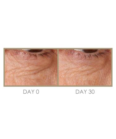 GENIE H Eye Drator PLUS Eye Cream - Hydrating & Rejuvenating Eye Treatment for All Skin Types - Shop Internationally - Buy Online on GoSupps.com
