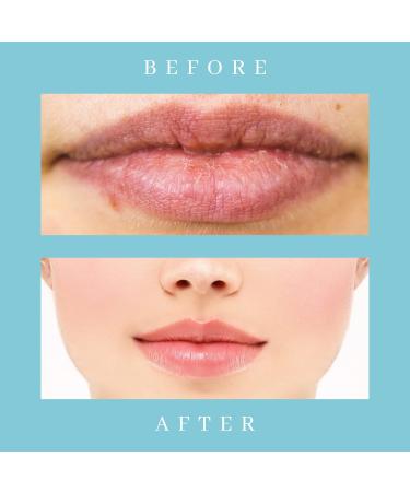 kukubird Hydrating Non-Sticky Flavoured 3pc Lipbalm Set For Dry Lips Long Lasting Moisturizing Lip Blams-Tropical - Buy Online on GoSupps.com