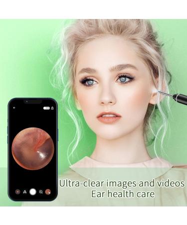 VITCOCO Ear Wax Removal Kit - 1920P HD Otoscope for iPhone & Android - 6 LED Lights - Visual Ear Scope for Ear Cleaning - Ear Camera Tool - Buy Online on GoSupps.com