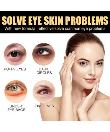 Vitamin C Eye Cream Stick Glow Vitamin C Eye Balm Eye Cream Anti Aging Eye Cream for Dark Circles and Puffy Eyes Cooling & Hydrating Eye Bags Remover Anti Wrinkle Eye Cream Eye Care Products - Buy Online on GoSupps.com