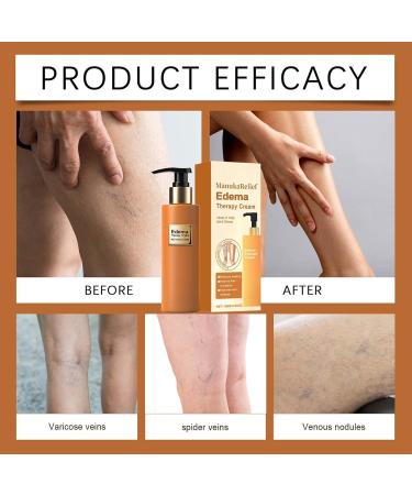 Cr me Jambes pour Peau S che | Cr me de Massage Apaisante Affinement Mollet Soulagement Musculaire Hydratant pour Femmes Adultes Voyage Maison - Buy Online on GoSupps.com