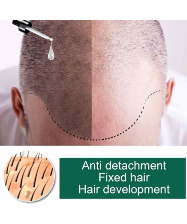  Stronrive Hair Growth Oil Hair Growth Strengthening Oil Hair Growth Oil Natural Growth Care Oil Nourishing Care for Stronrive Ends - Buy Online on GoSupps.com