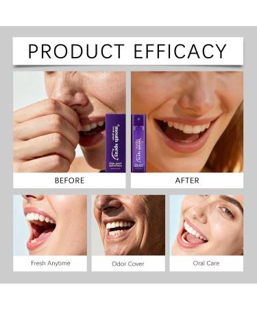 Mouthwash Spray 10ml Toothpaste Stain Removal Mist Flavored Spray In Travel Size | For Women And Men With Sensitive Gums Throat And Teeth - Buy Online on GoSupps.com