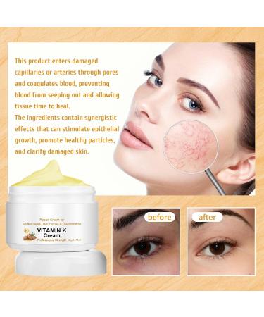 EXQST Fivfivgo Varicose Veins Miracle Cream Treatment Cream for Varicose Veins Improves Circulation - Buy Online on GoSupps.com