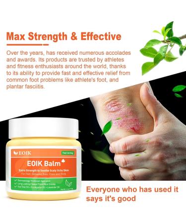 Heat Rash Cream  Eczema  Hand Foot Treat  Tinea Versicolor  Itchy Feet  Butt  Anal Itch  Psoriasis  Scalp Dandruff  Bee Sting  Bites  Boil Cyst  Armpit  Adults Kids  Hidradenitis Suppurativa Treat - Buy Online on GoSupps.com