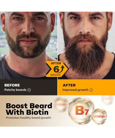 Waking Forest Beard Growth Kit | Luxury Beard Care for Men - Oil Wash Conditioner Balm & Comb - Buy Online on GoSupps.com