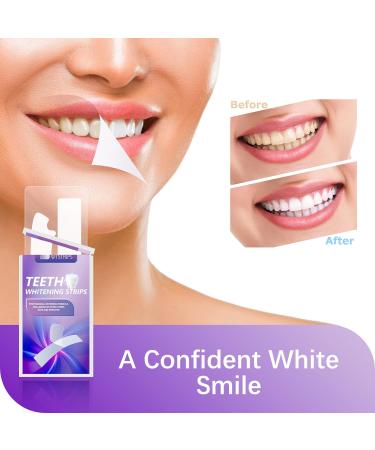 Teeth Whitening Strips 28-Strip Kit | Professional Effects with Reduced Sensitivity | Coconut Flavor | Dental Whitener for Whiter Teeth - Buy Online on GoSupps.com