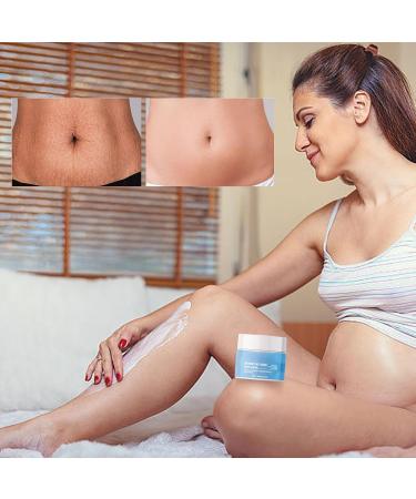 Stretch Marks Removal Winning Stretch Mark Reduction for Women Cream for Stretch Mark Removal Skin Repair Cream for Old and New Stretch Marks - Buy Online on GoSupps.com