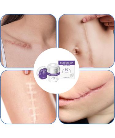 Antiscar cream 50 g scar cream skin care for spots wounds caesarean section old new scars burns legs - Buy Online on GoSupps.com